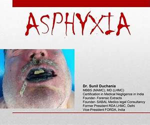 Asphyxia