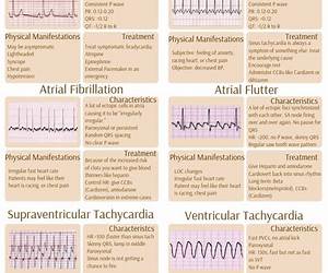 EKG Technician Study Guide (Exam Prep Series)