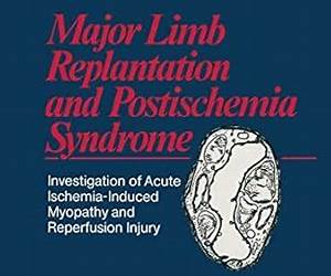 Major Limb Replantation and Postischemia Syndrome: Investigation of Acute Ischemia-Induced Myopathy and Reperfusion Injury