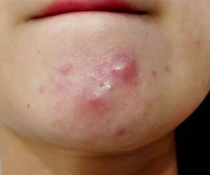 The Skin on My Chin The Skin on My Chin