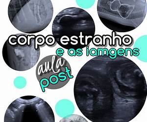 Um Corpo Estranho